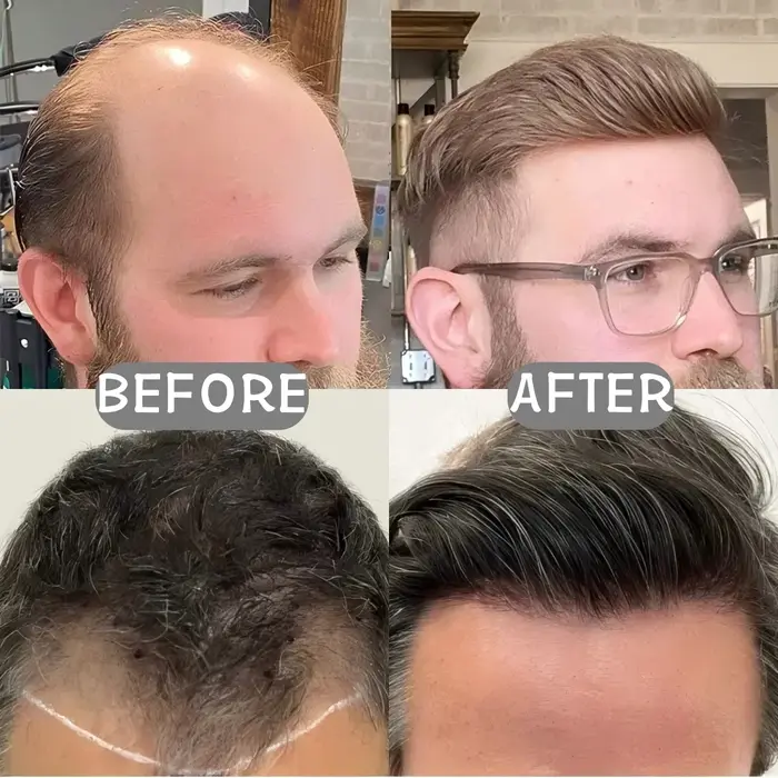 Perruque frontale pour hommes; Postiche frontale en PU pour hommes, cheveux humains haute densité, a