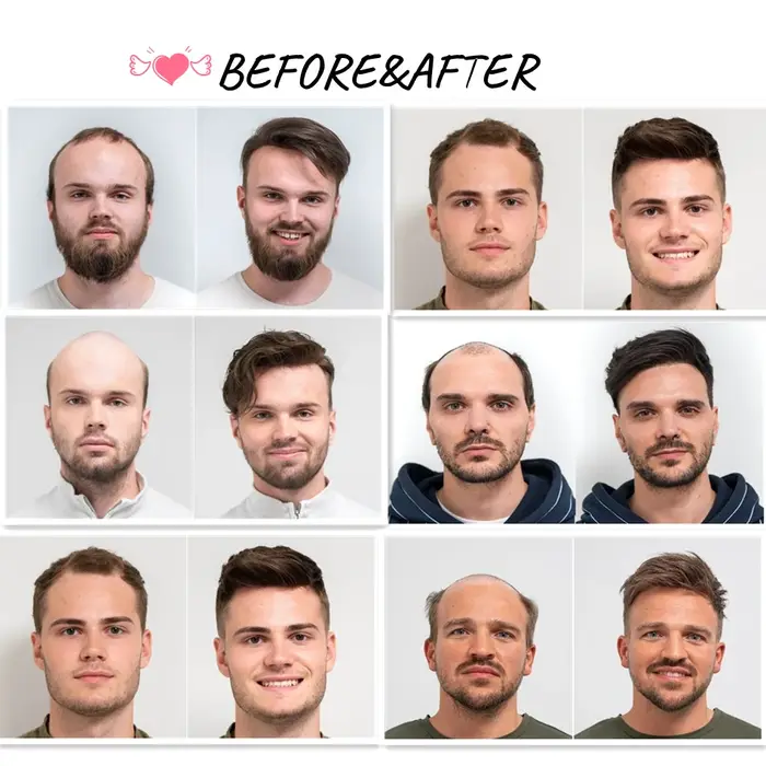 Perruque Toupet en Cheveux Naturels Mono Fin pour Homme