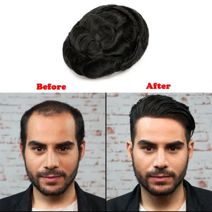 Prothèse capillaire pour homme