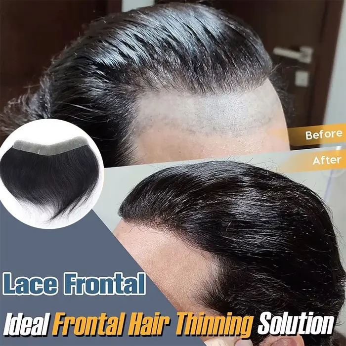 Cheveux humains naturels front délié toupet hommes prothèse capillaire peau mince postiche système de remplacement Remy