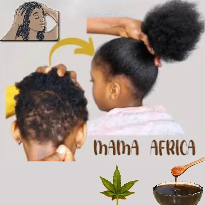 Traitement de Traction d'alopécie pour femmes africaines