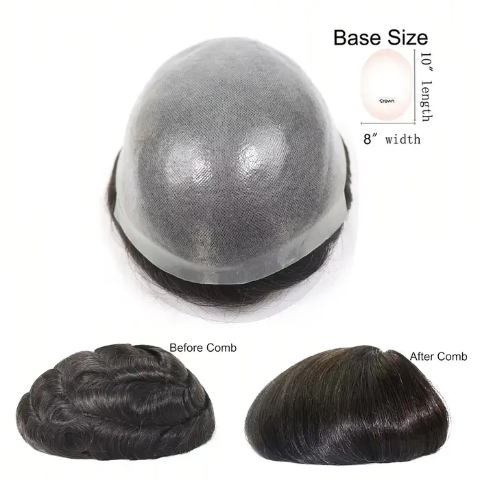 Toupet de peau fine, cheveux naturels, naissance des cheveux naturelle, prothèse capillaire à Double