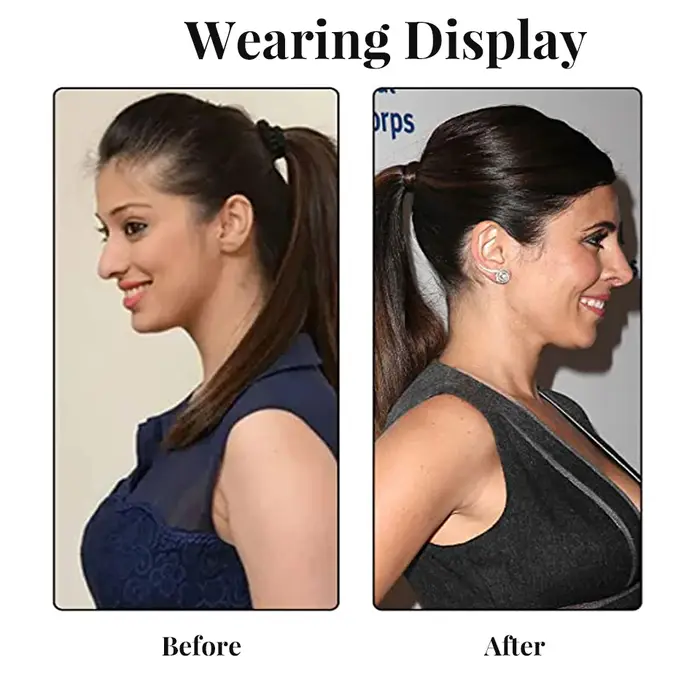 Prothèse capillaire pour racines de cheveux stabilisées